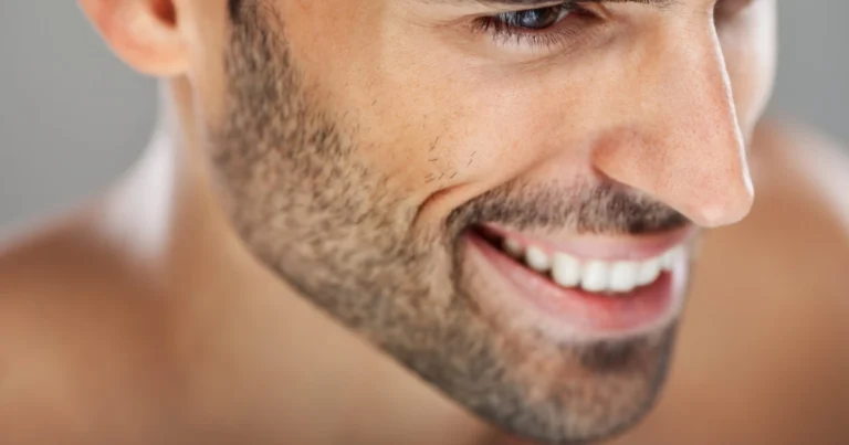 Barttransplantation bei LH Aesthetic