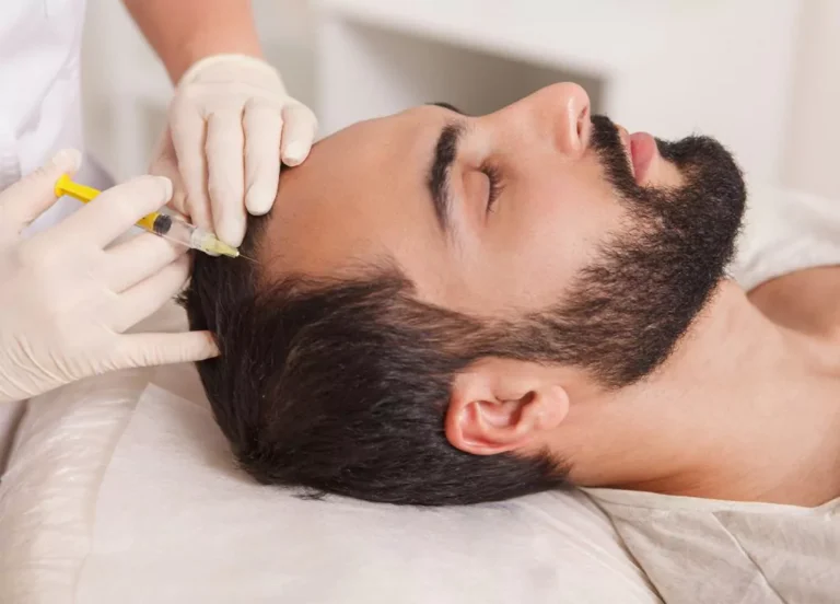 Ursachen für Haarausfall – Ein umfassender Ratgeber